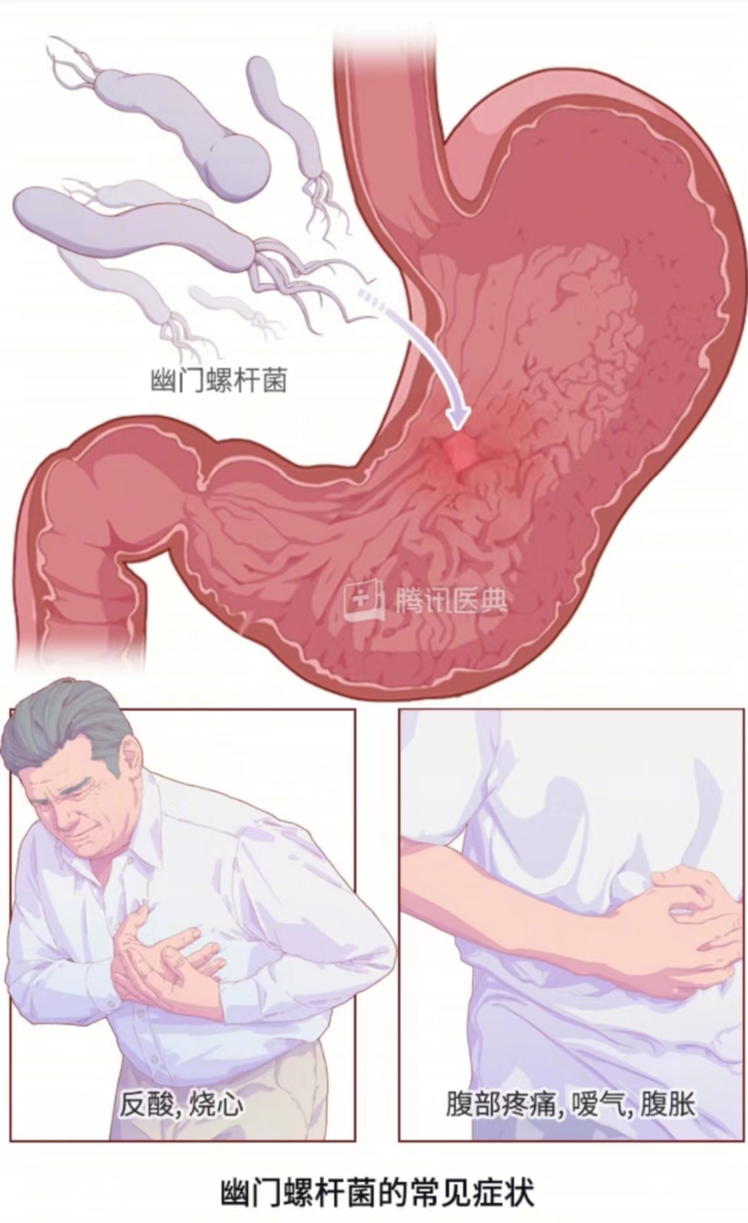 對(duì)付幽門螺桿菌，真的不能靠吃大蒜