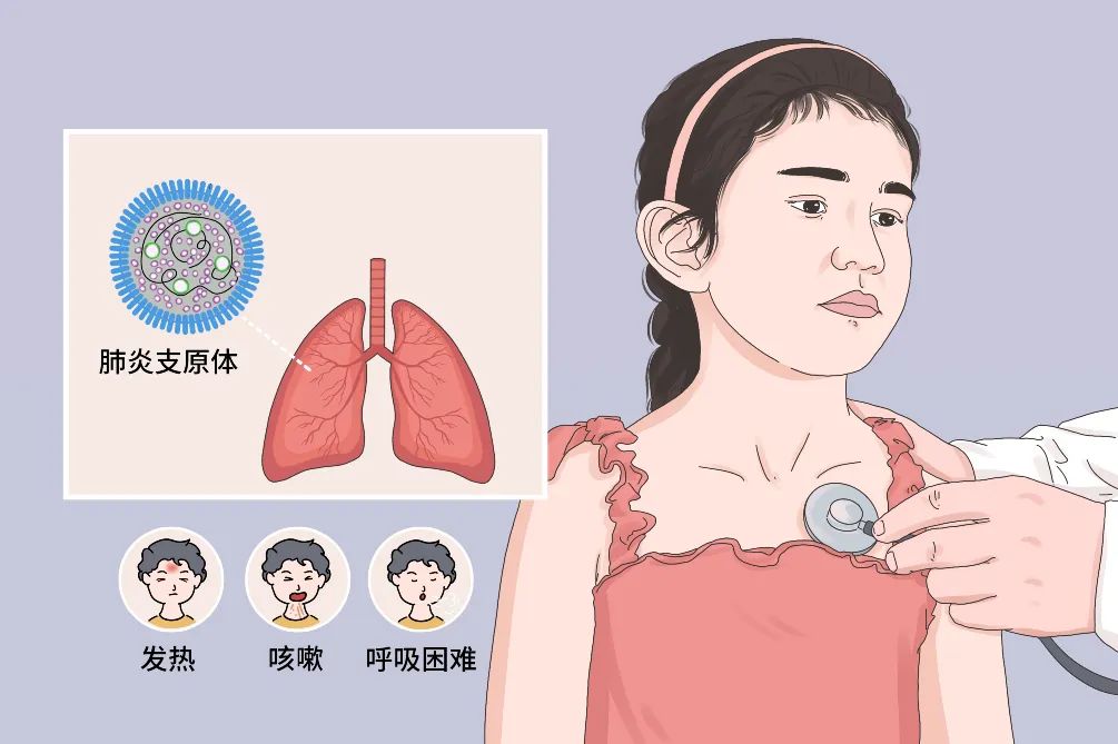 不是所有的肺炎都一樣:肺炎支原體快問快答 不是所有的肺炎都一樣:肺炎支原體快問快答