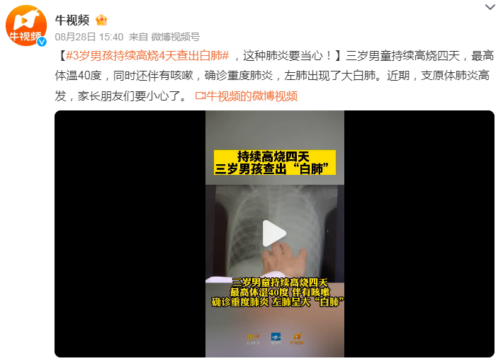 高燒4天，3歲娃查出“白”肺！近期很多孩子中招，要當(dāng)心→