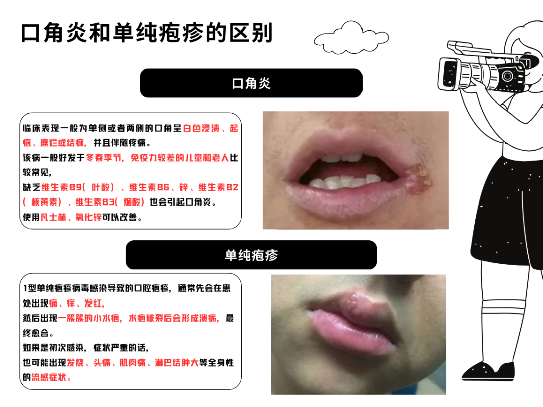 傳染性極強，這個病毒一旦感染“終身攜帶”，看似感冒卻更兇險