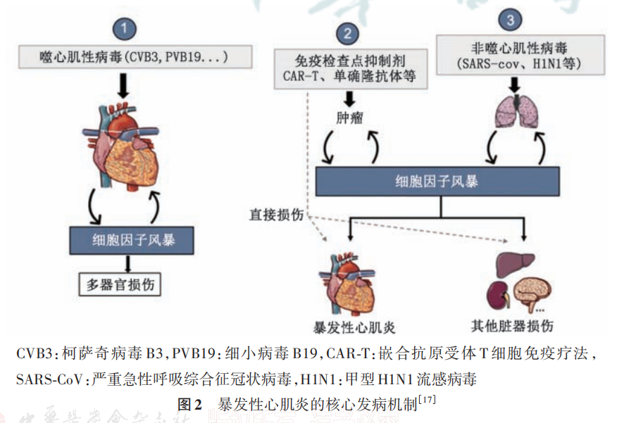 11歲男孩發(fā)燒后心臟停跳52小時(shí)！這種病死亡率極高